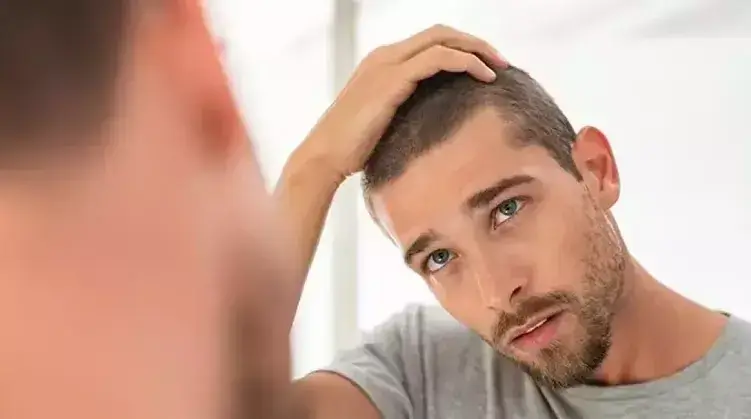 Hair Loss in Men